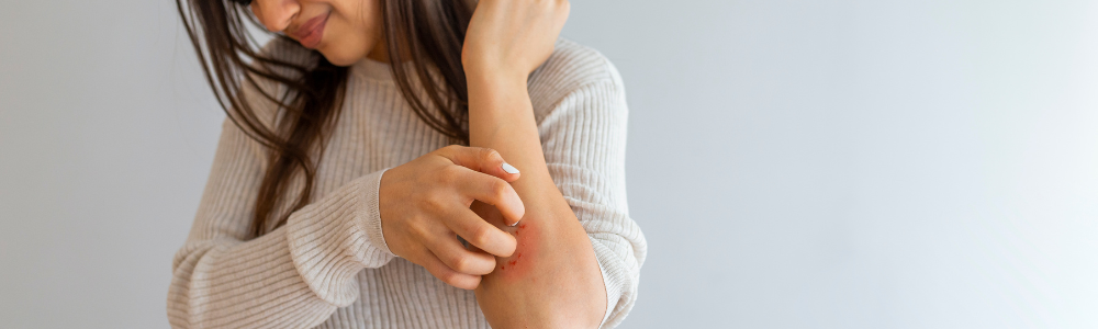 Eczema vs Psoriasis – What To Know