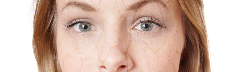 woman with dry skin on face